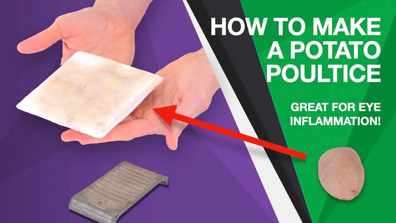 How to Make a Potato Poultice