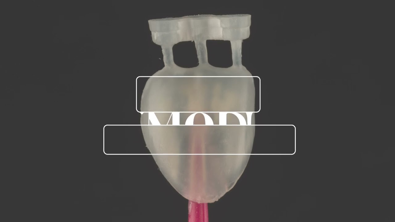 Feldspathic Veneers, the gold standard no prep veneer