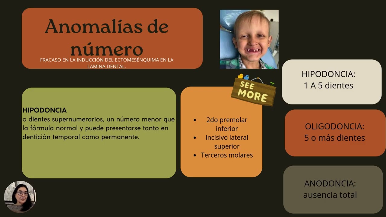 Anomalías