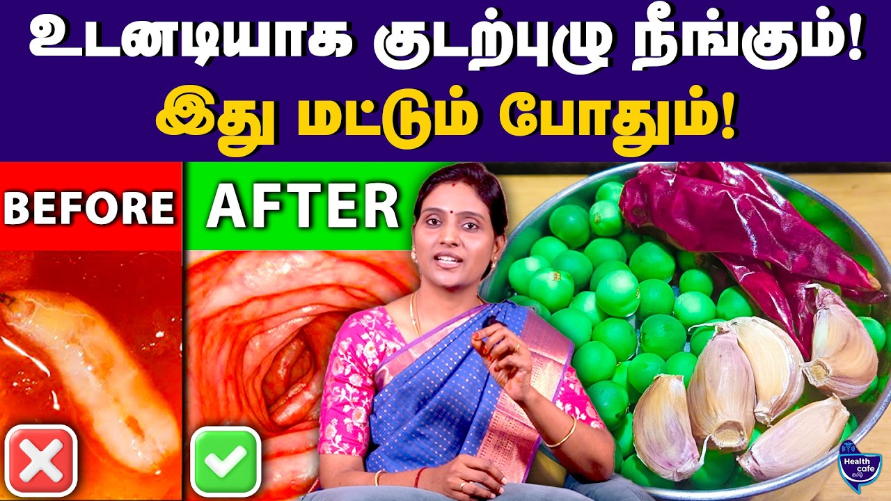 மோர் உடன் இத குடிங்க.. குடல் புழுக்கள் இறந்துவிடும் | Health Cafe Tamil