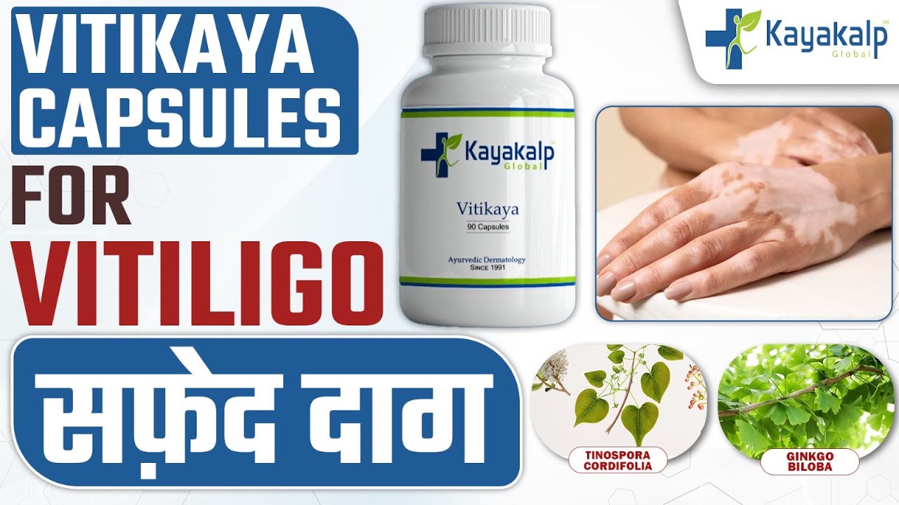 Vitikaya Capsules💊 for Vitiligo (सफ़ेद दाग) | Best Medicine for Vitiligo | Kayakalp Global