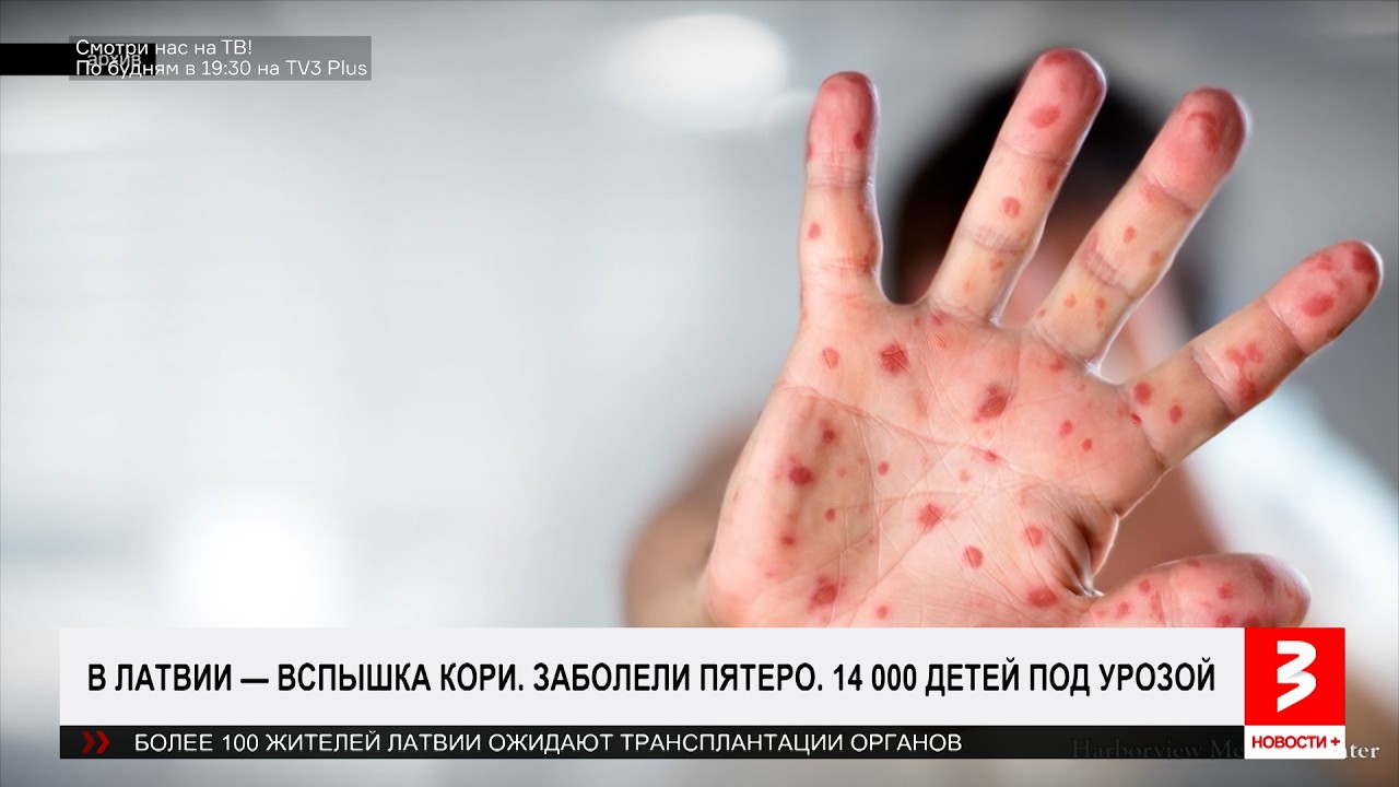 14 тысяч детей под угрозой. «Новости+», 18 марта 2026 г.