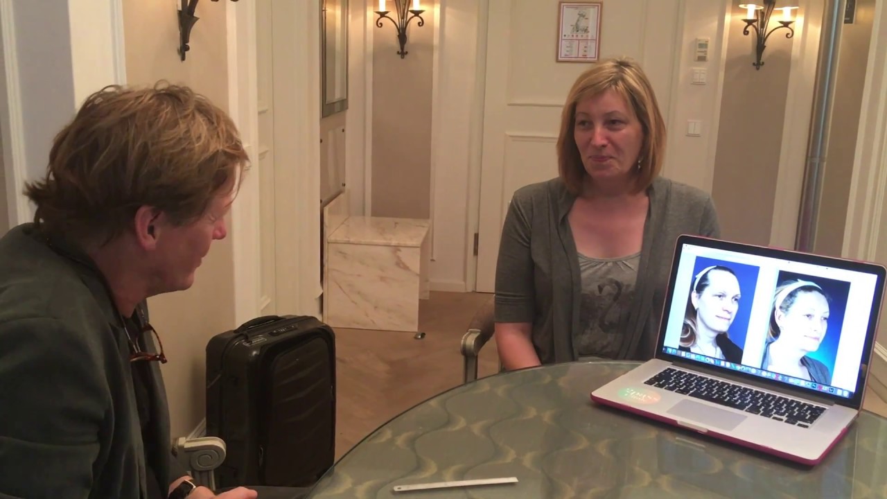 Facial feminization surgery review - Lena, Dr Bart van de Ven reviews