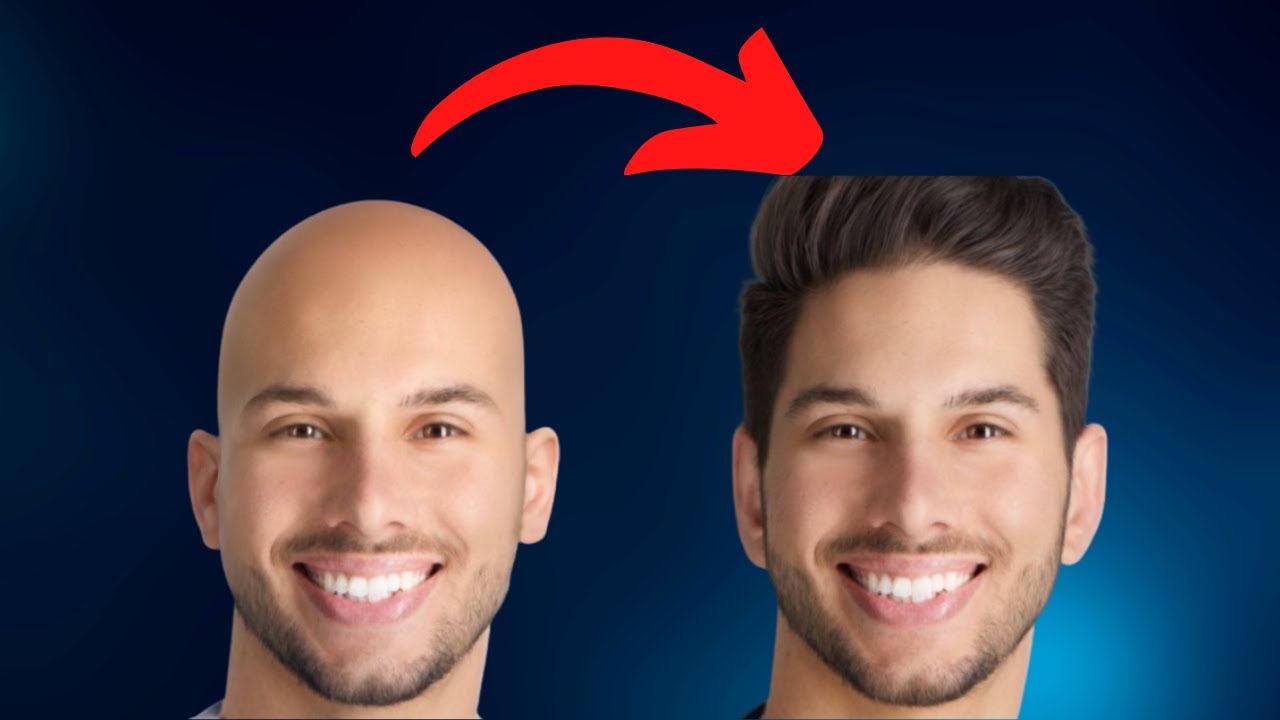 Male pattern baldness cure - How to treat hair loss for men (4 steps)