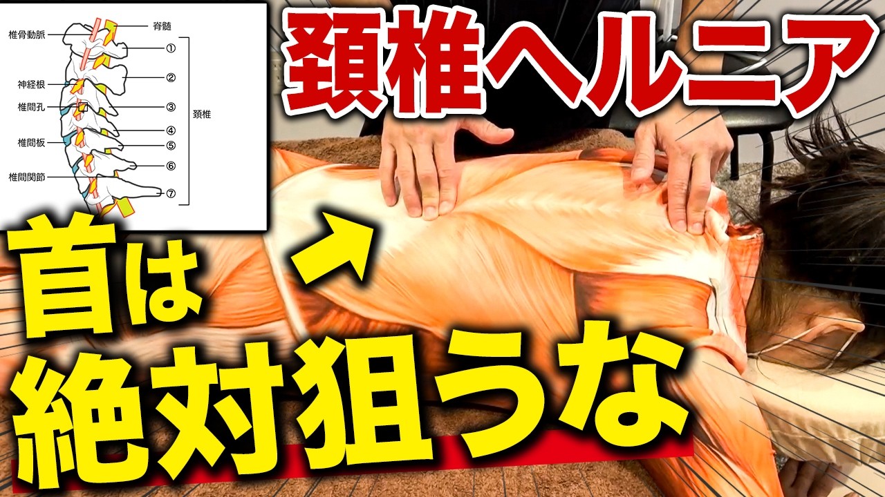 【永久保存版】9割の治療家が理解していない！頚椎ヘルニアの治療法について1から徹底解説します！！