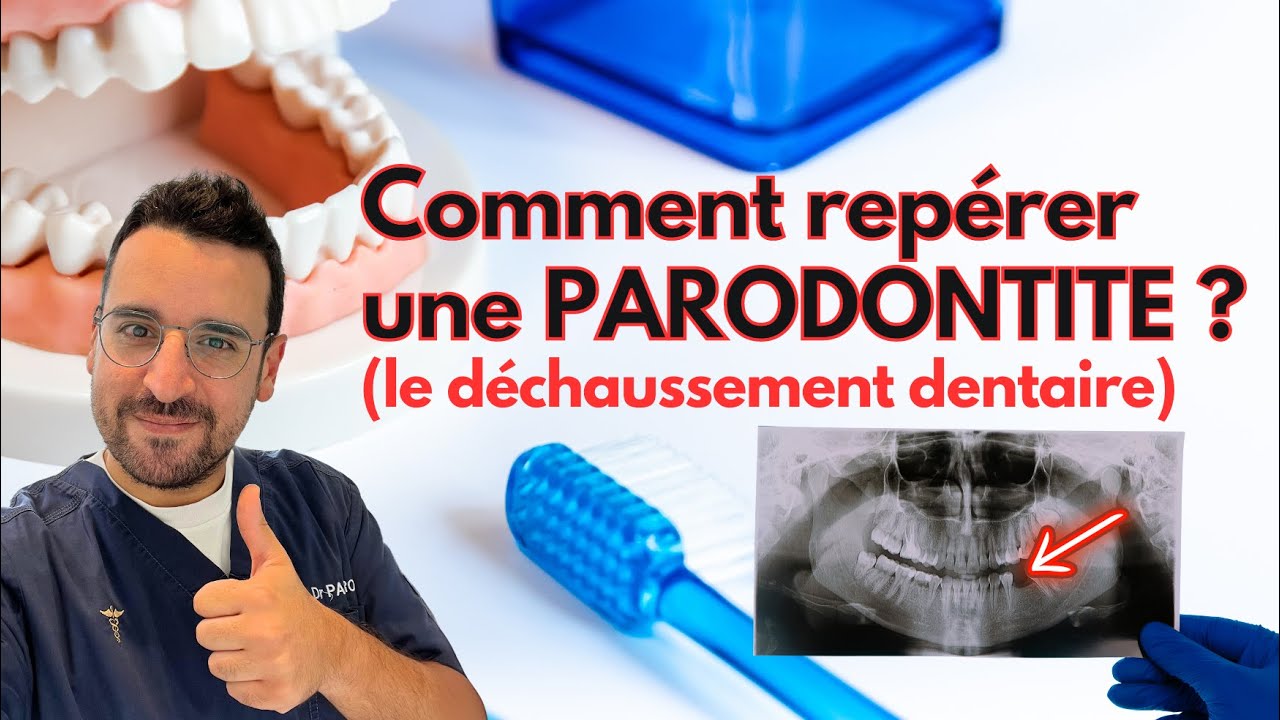 Apprendre à REPÉRER une PARODONTITE dentaire