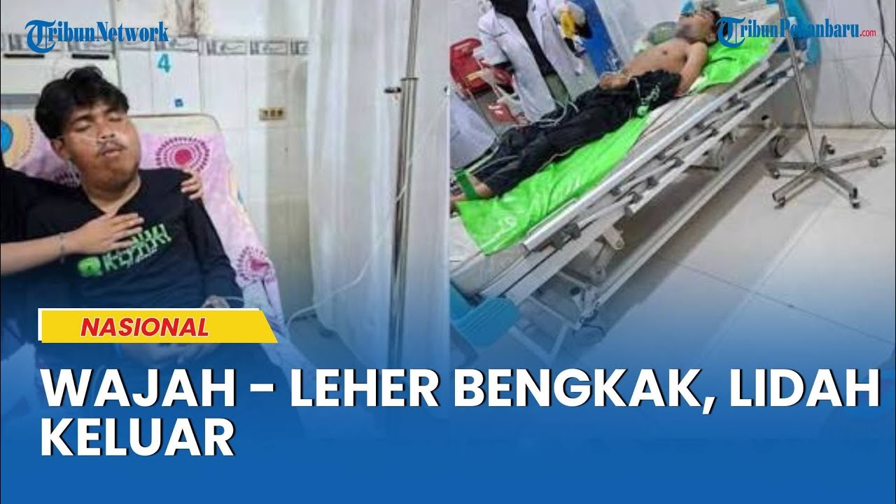 Diduga Dianiaya, Mahasiswa UNG Tewas Usai Diksar Mapala: Wajah-Leher Bengkak, Lidah Keluar
