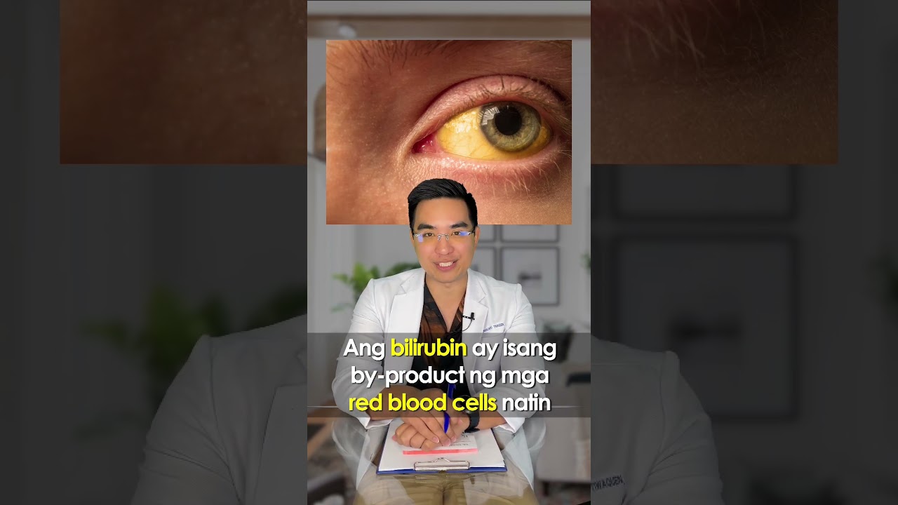 Yellow ang mata? #kilimanguru