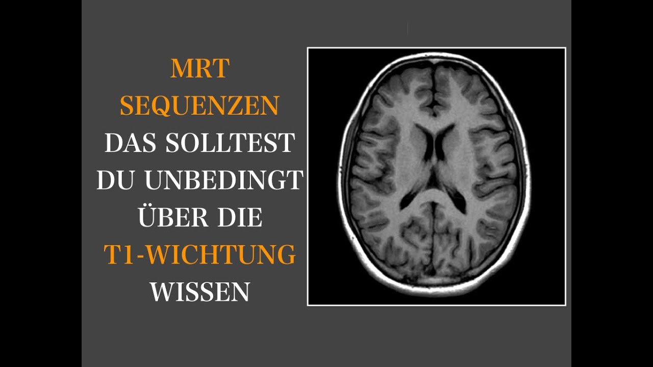 MRT Sequenzen I T1w I Gehirn I Neuroradiologie I Brain & Synapse