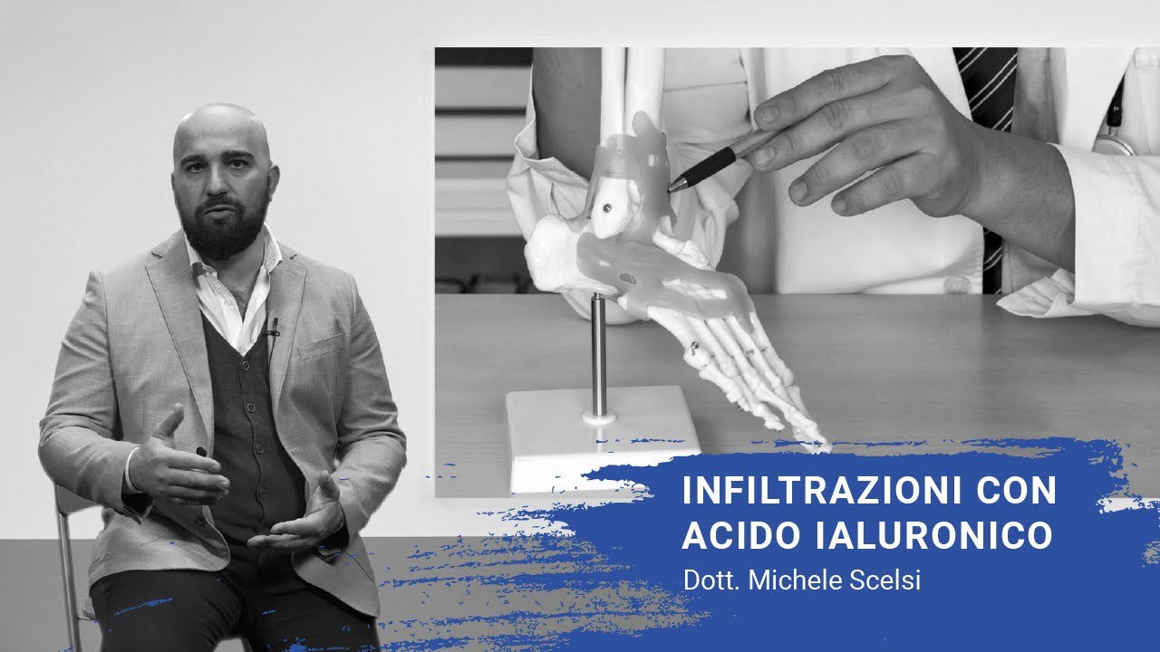 Infiltrazioni con acido ialuronico - Dott. Michele Scelsi