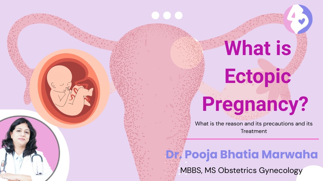 Ectopic Pregnancy Explained |by Dr. Pooja Bhatia Marwaha