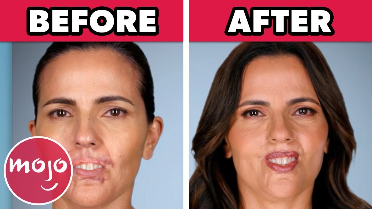 Top 10 Unbelievable Transformations on Botched