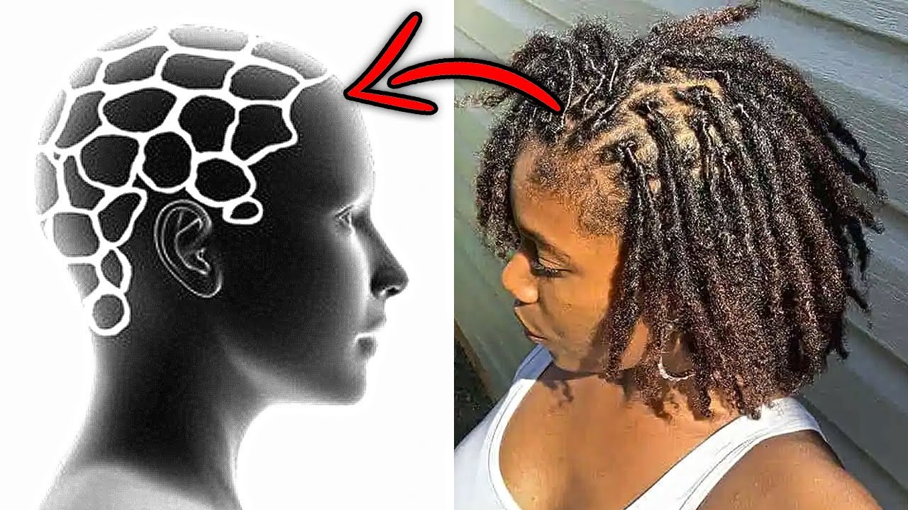 How To Section Your Hair For Dreadlocks