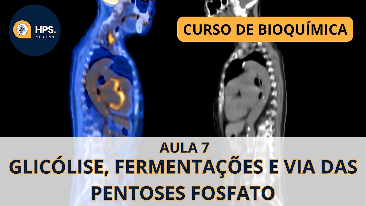 AULA 7 - Via Glicolítica, Fermentação Láctica e Via das Pentoses-fosfato #medicina #pet-ct #cancer