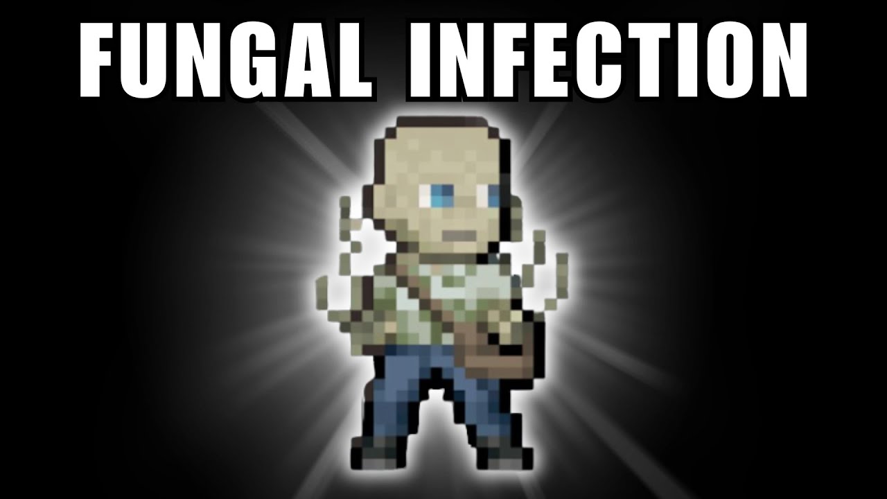 Cdda challenges: Fungal Infection