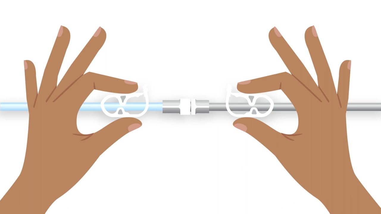 3M™ ActiV.A.C.™ Therapy Unit Patient Return Video