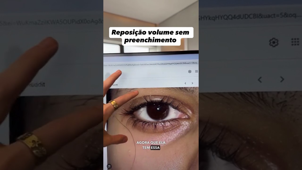 QUAL É O MELHOR CREME E LASER?