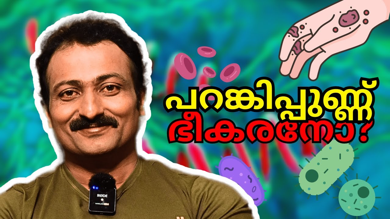 സിഫിലിസ് | Augustus Morris