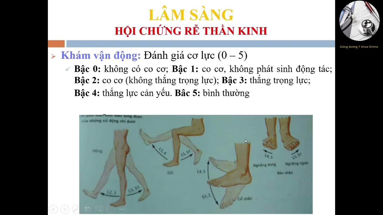 HỘI CHỨNG ĐAU THẮT LƯNG HÔNG | BS. PHƯƠNG THANH HÀ