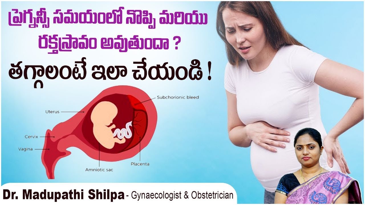 గర్భధారణ సమయంలో బ్లీడింగ్.! | Subchorionic Hemorrhage in Early Pregnancy | Dr Shilpa Women's Clinic