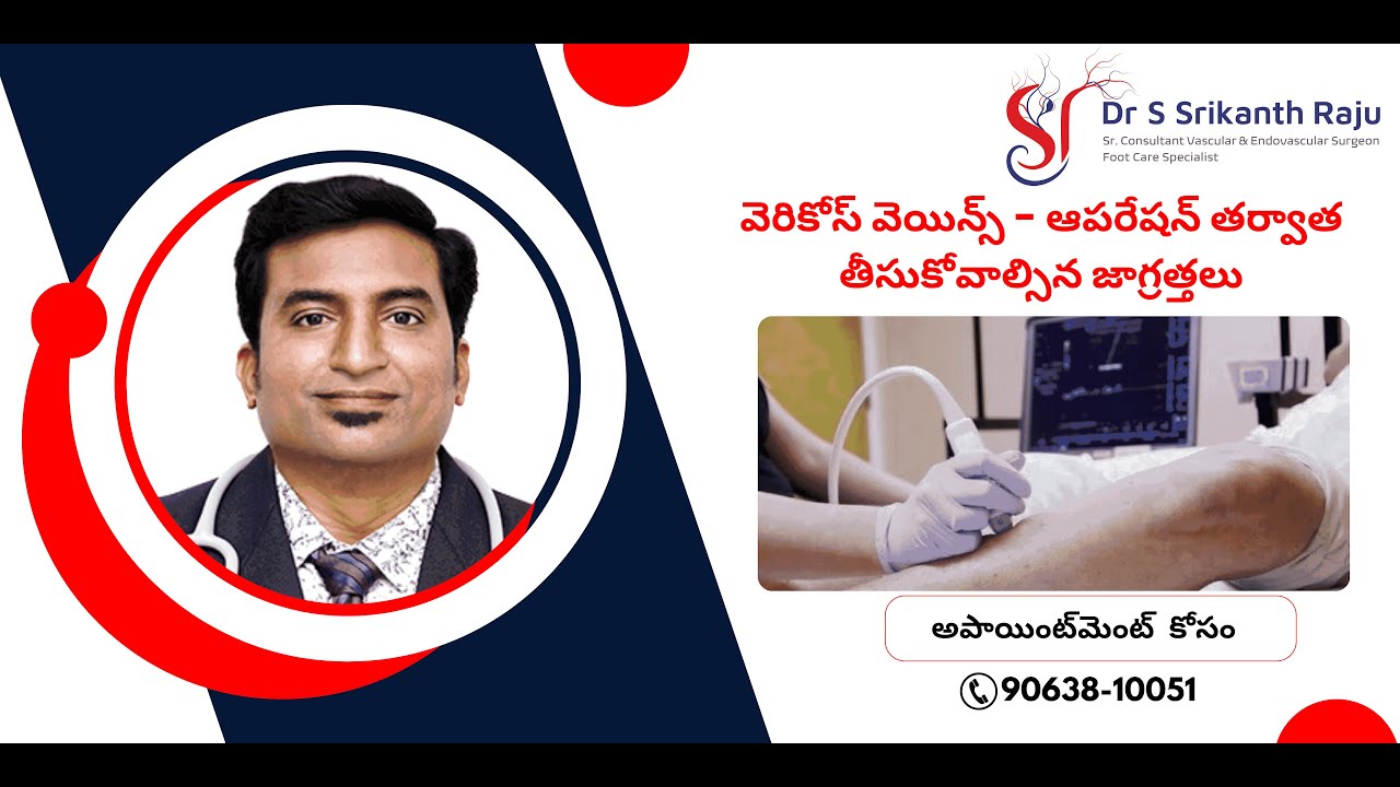 వెరికోస్ వెయిన్స్ - ఆపరేషన్ తర్వాత తీసుకోవాల్సిన జాగ్రత్తలు | డా.శ్రీకాంత్ రాజు | వాస్కులర్ సర్జన్