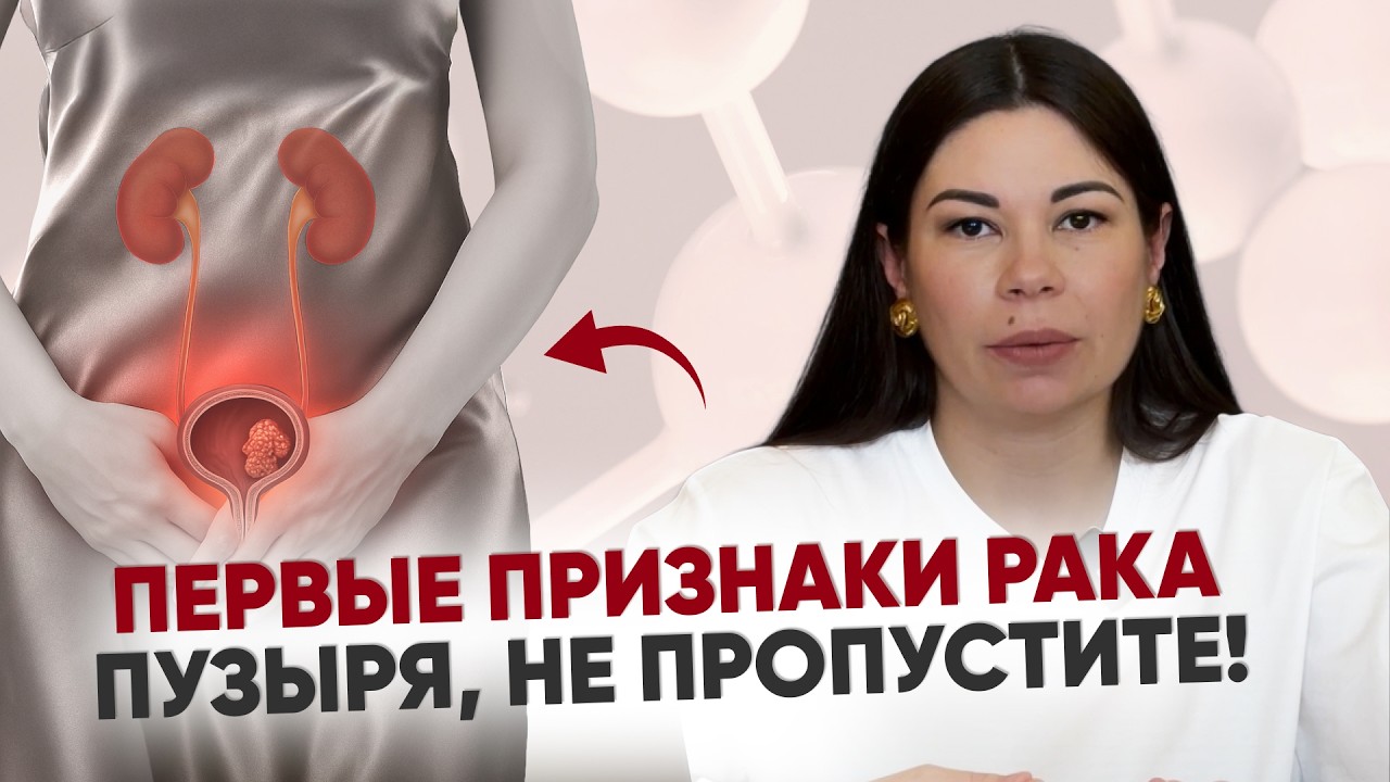 Может ли цистит привести к раку?