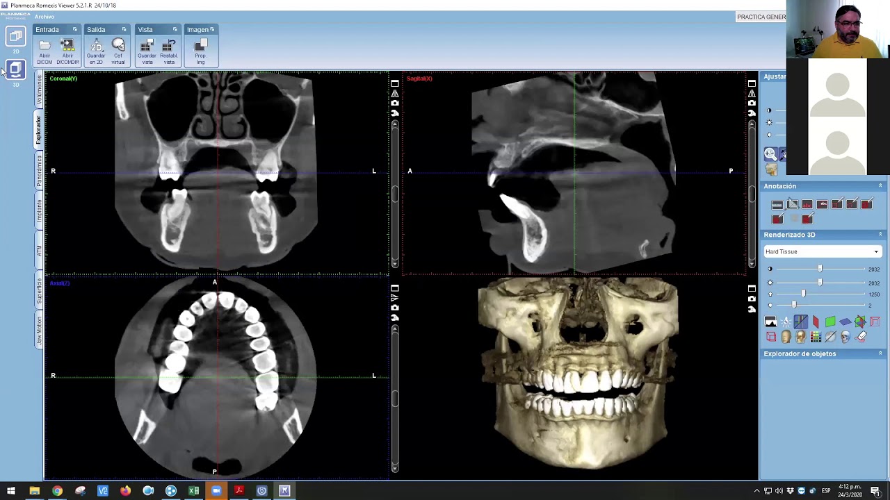 3-1-CURSO DE ROMEXIS VIEWER (1ra. Parte)