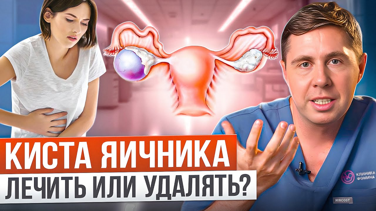 Киста яичника: когда нужна операция? Симптомы кисты яичника. Лечение кисты яичника.