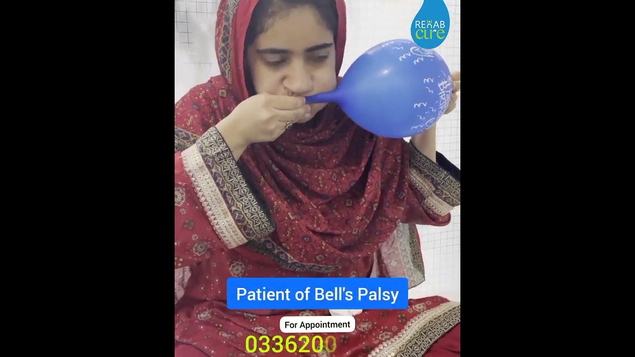 #bellspalsy #bellspalsytreatment #bellspalsycure #shorts