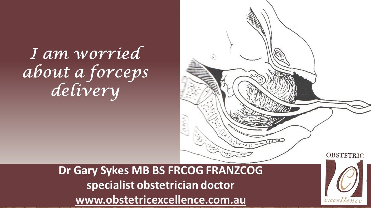 I am worried about a forceps delivery
