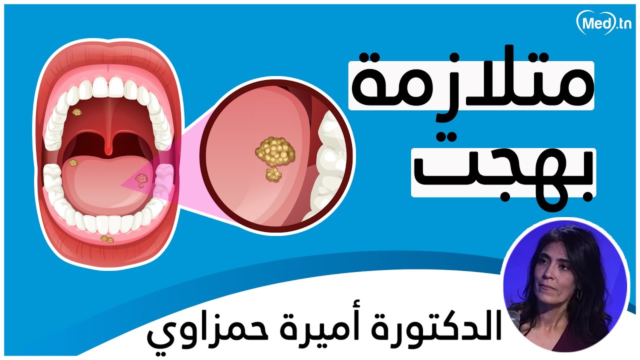 متلازمة بهجت | الدكتورة أميرة حمزاوي