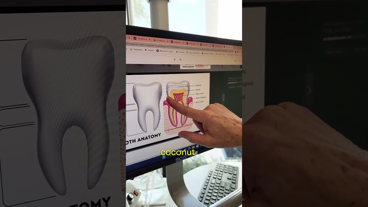 BENEFITS OF COCONUT OIL PULLING 🥥🦷