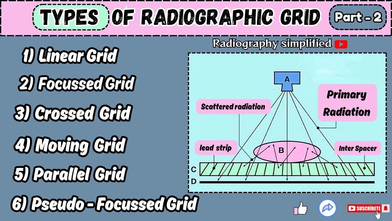 Types of Grid ll Anti scattered grid ( part -2 ) ll Radiography simplified