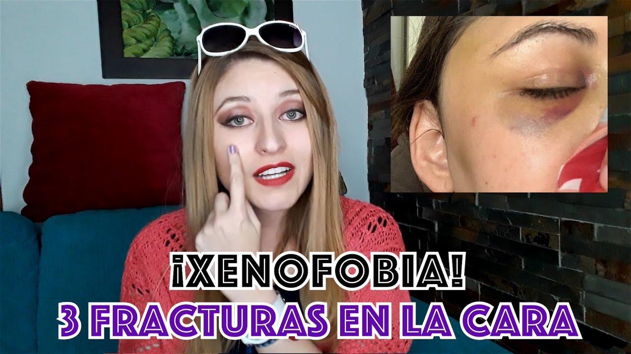 &iexcl;XENOFOBIA! Golpearon a una amiga en Nueza Zelanda / PAPS #papstory