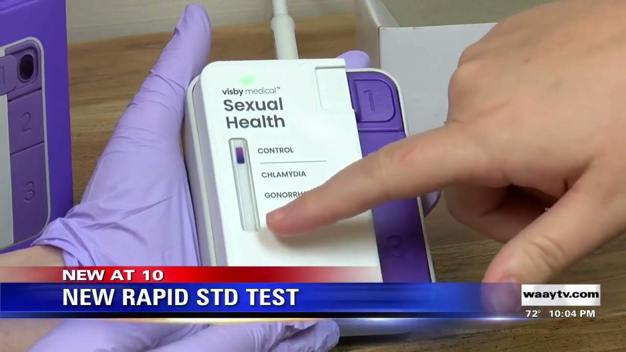 Visby Medical STD test, used in Madison County Clinic, featured on WAAY 31 TV