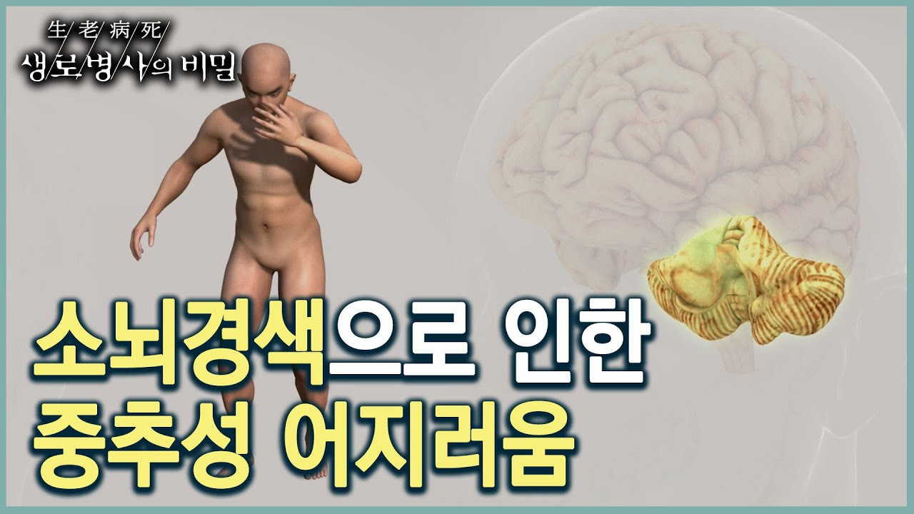 보행 장애와 일렁이는 어지러움이 있다면... (KBS 20220810 방송)