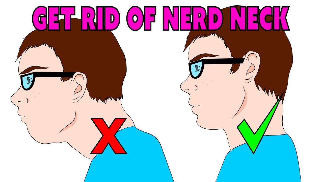 The 4 minute natural fix for forward head posture, nerd neck & anterior head carriage
