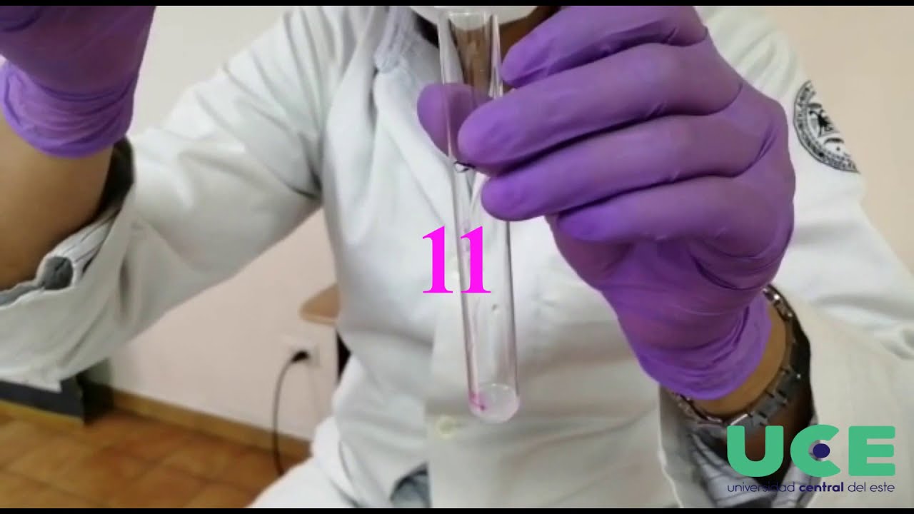 Práctica de identificación de alteraciones del equilibrio ácido-base.