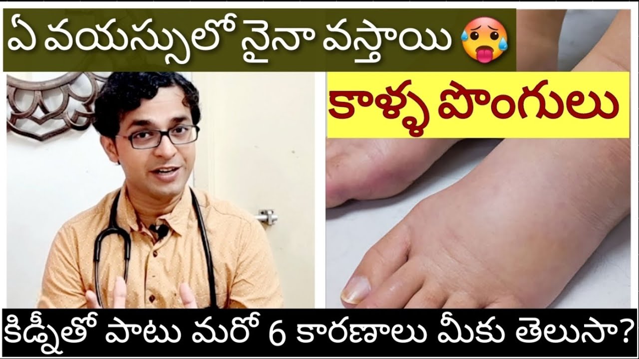 కాళ్ళ వాపులకి కారణాలు, ఇంట్లోనే తేలికగా పాటించగల్గిన చిట్కాలు - Pedal Edema/ swelling in feet