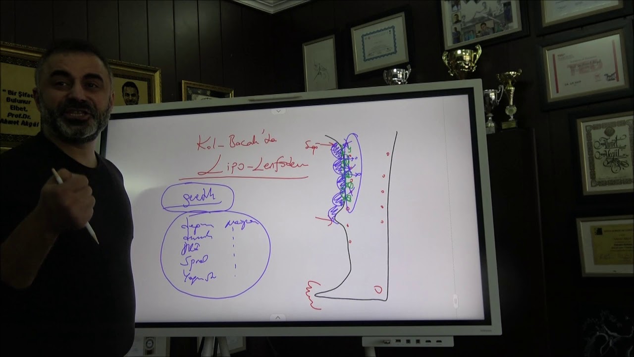 Kol ve Bacakta oluşan, Yıllarca tanı konamamış hastalık: Lipo-Lenfödem - Prof Dr Ahmet AKGUL