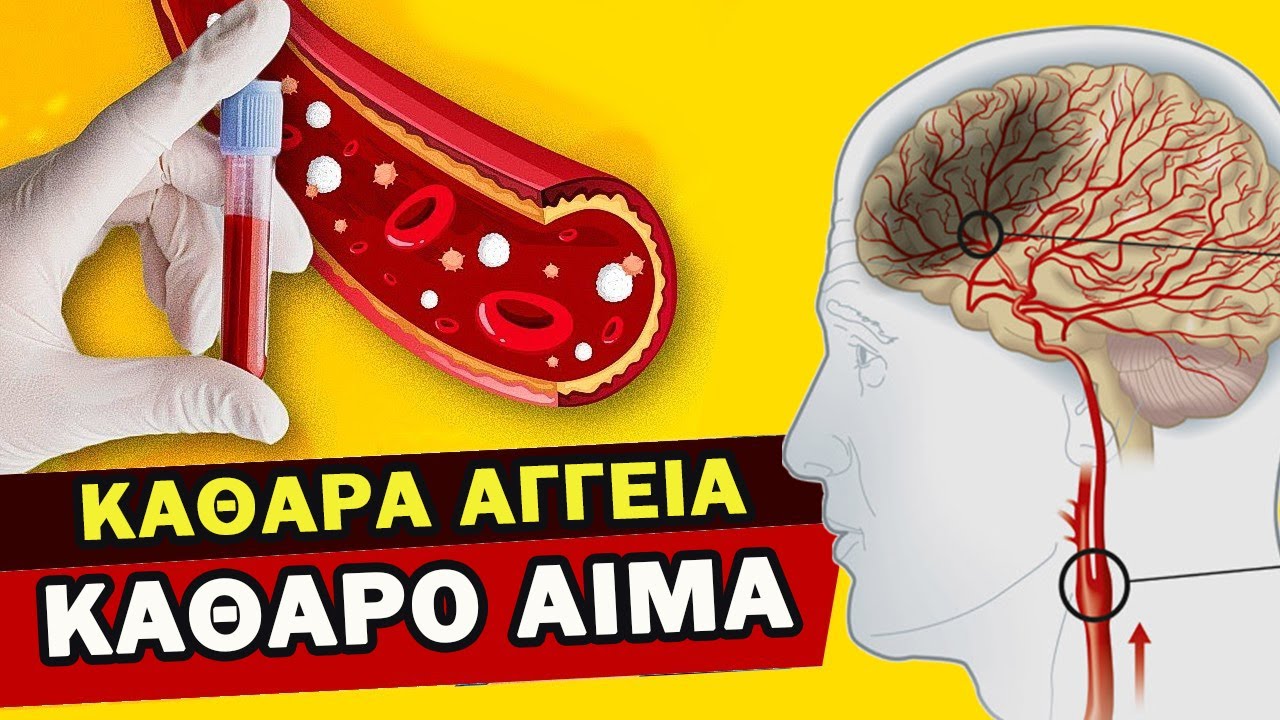 #1 ΛΙΠΟΣ ΣΤΑ ΑΓΓΕΙΑ - Πως Να Καθαρίσετε Τα Αγγεία Από Την Χοληστερίνη; | Ακαδημία Υγείας