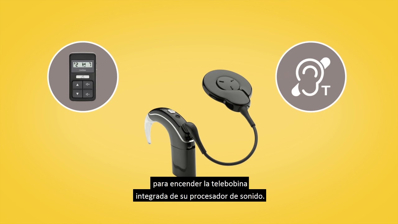 Con los dispositivos Cochlear™ True Wireless™ puede trasmitir sonido de forma inalámbrica