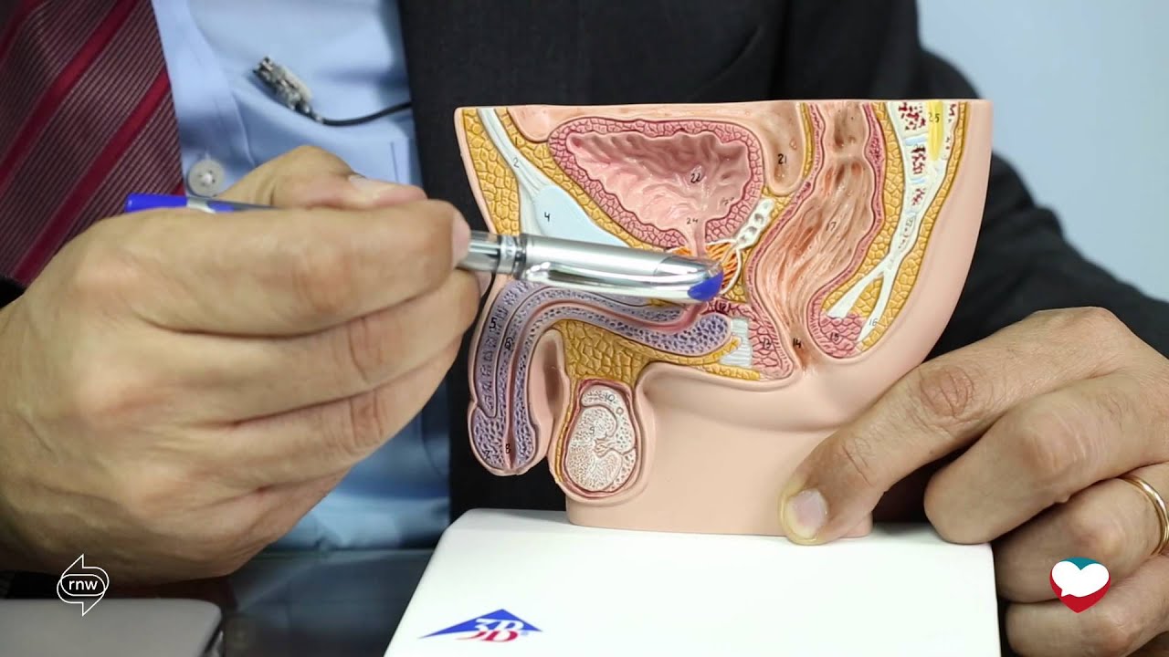 5  Delayed and retrograde ejaculation   القذف المتأخر والقذف المرتجع