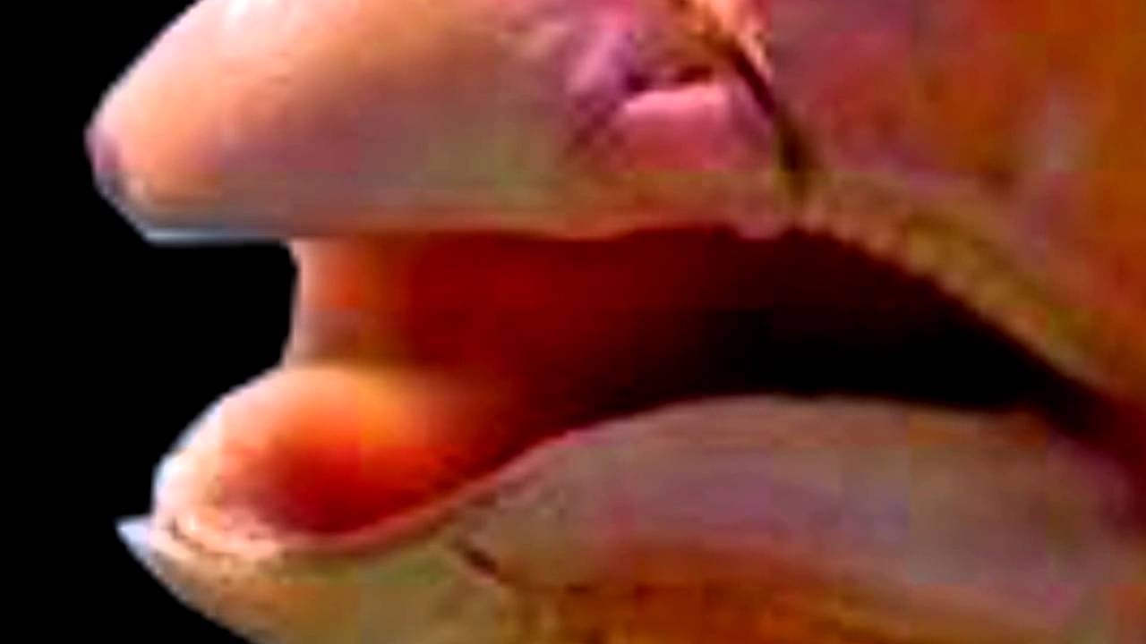 MemeMaster420 vs DolanDark