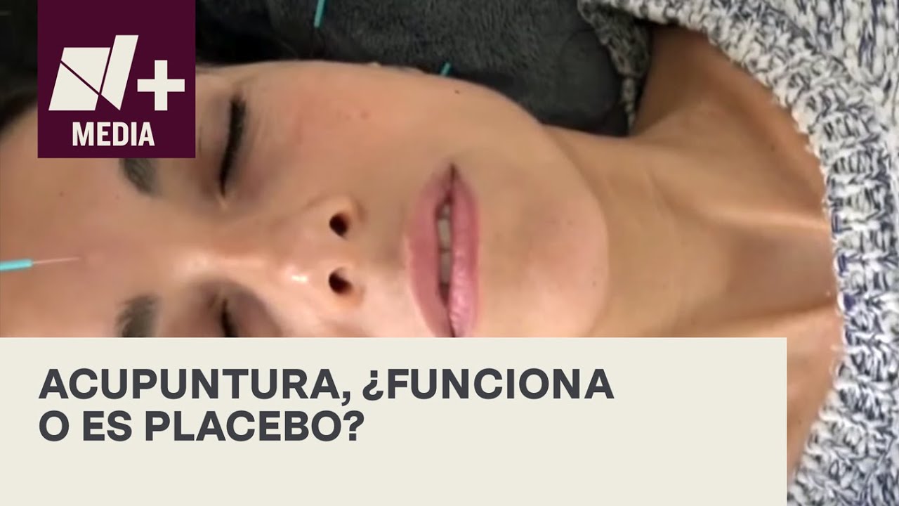¿Realmente funciona la acupuntura? - Bien y de Buenas