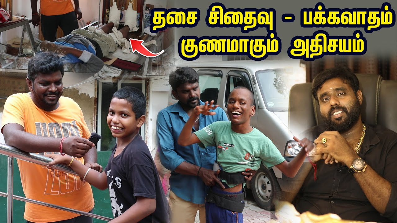 நடக்க முடியாத குழந்தைகள் நடக்கும் அதிசயம்  I  Muscular Dystrophy Treatment I Village Data Base