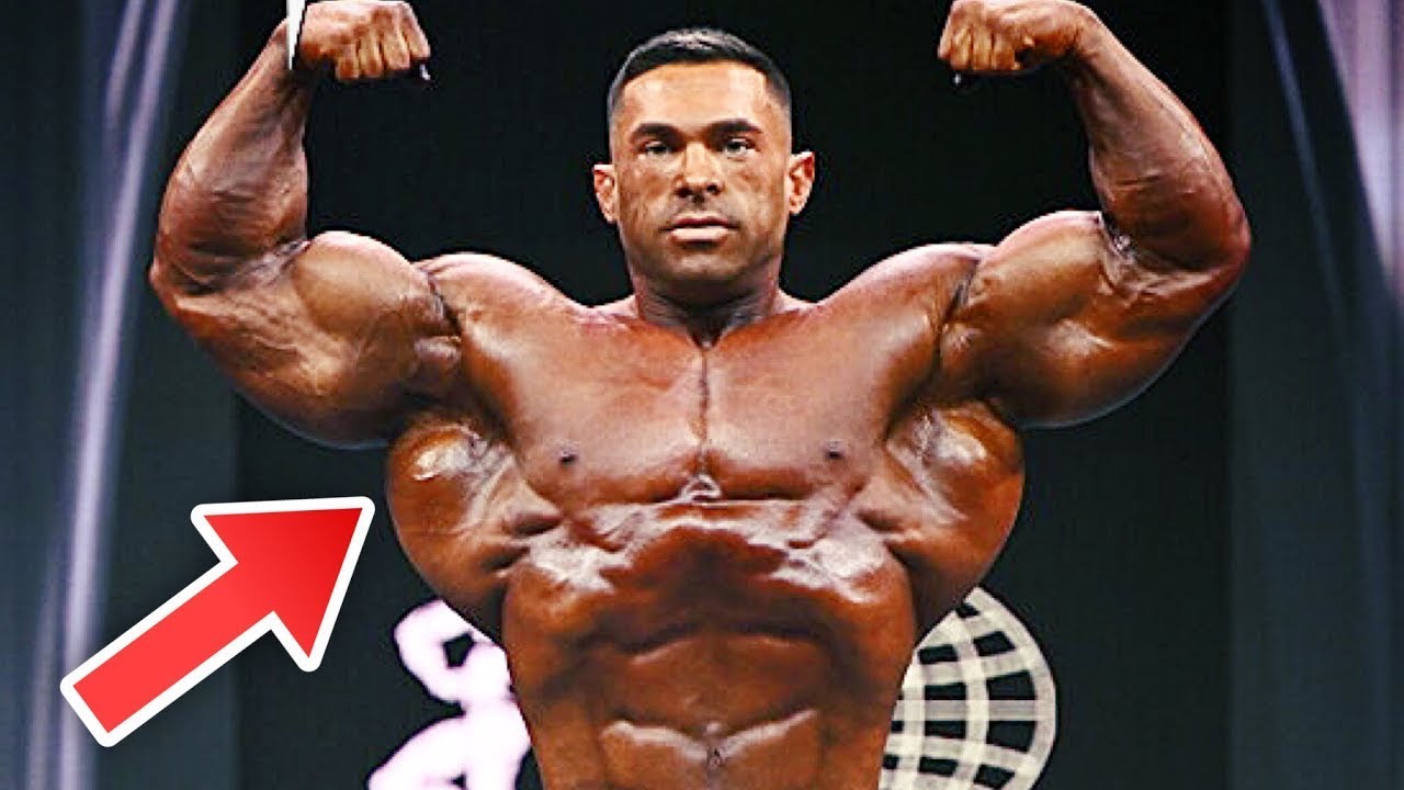 DEREK LUNSFORD Has Synthol  in His Arms ?