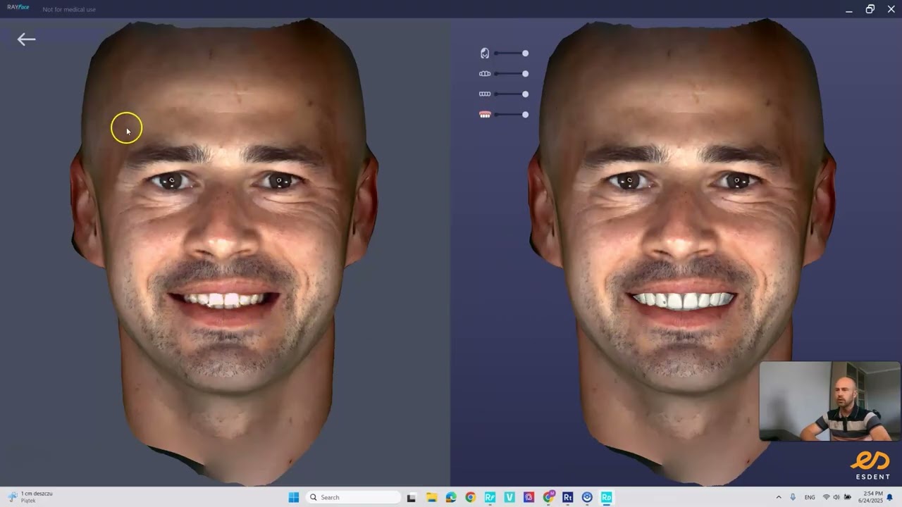 Jak zaprojektować uśmiech w oprogramowaniu RAYFace?