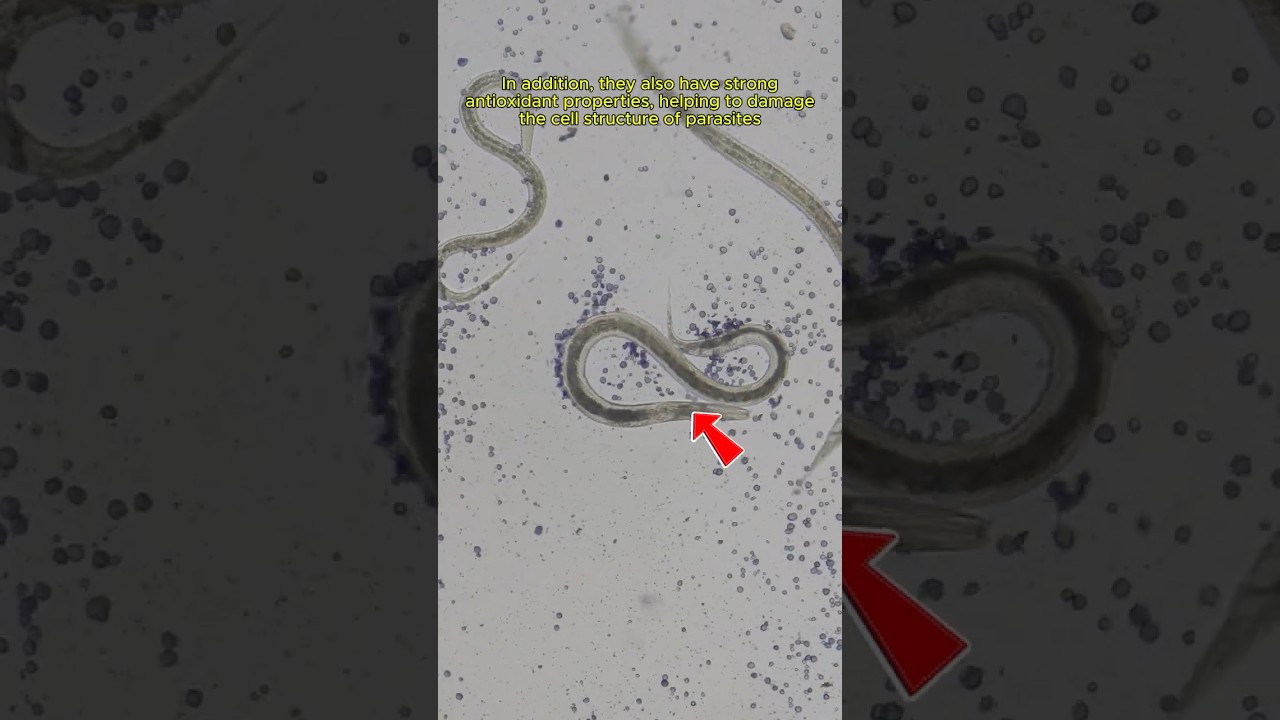 Ginger vs Human Parasites | TULO - Microscope#shorts #microscope #human