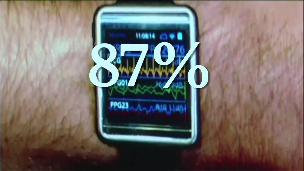 'No Diet Day' as weight-loss sector gets fatter | CNBC International
